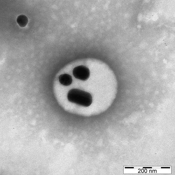 Transmission electron microscope image of hybrid silver/polymeric nanoparticles (NPs)