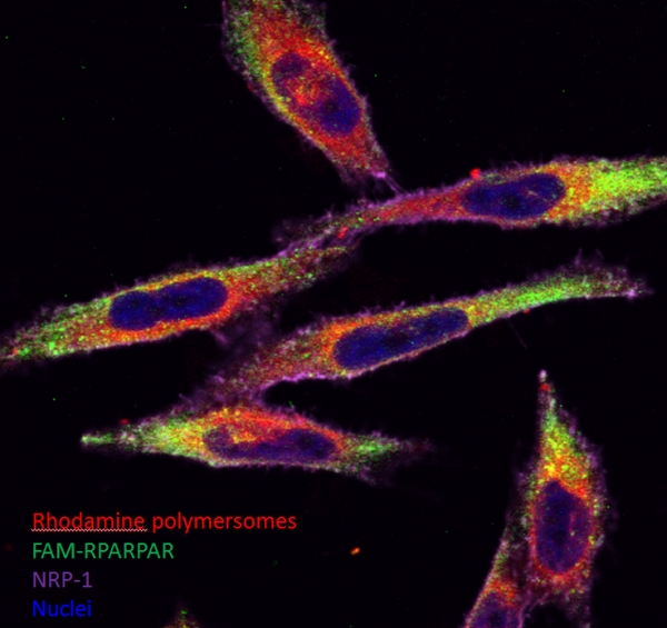 Confocal microscopy picture showing the internalization of polymersomes labeled with Rhodamine and targeted with RPARPAR-FAM peptide in PPC-1 cells. 63 x magnification.