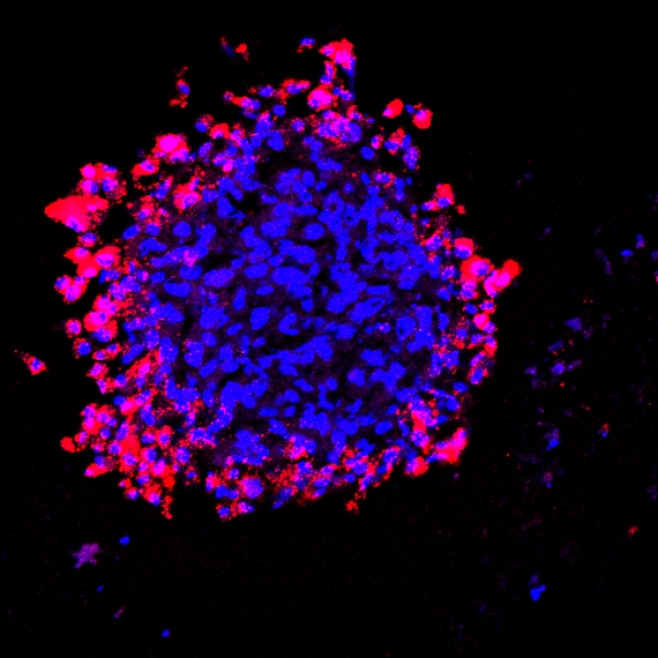 U87 cell line spheroids taking up RPARPAR-AgNPs (red)