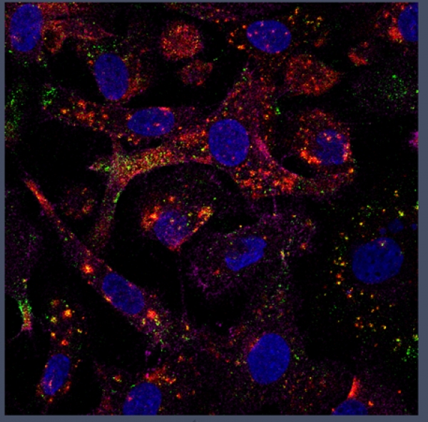 SKOV3 ovarian cancer cells