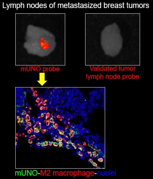 Lymph node imaging in metastatic dissemination Top: Whole lymph node fluorescence imaging of mice with metastasized breast tumors, injected with two different probes: a validated tumor lymph node targeting agent (top right), and mUNO (top left). Bottom: the signal from mUNO (green) in the lymph node associated with M2 macrophages (red). Authors: Anni Lepland, Pablo Scodeller.