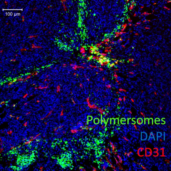 Homing of polymersome nanoparticles to peritoneal  colon carcinoma (CT26 Balb/c syngeneic  tumor model, sample collected 24 hours after injection)