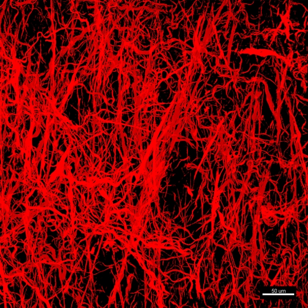 Second harmonic generation image of collagen fibers in mouse dermis