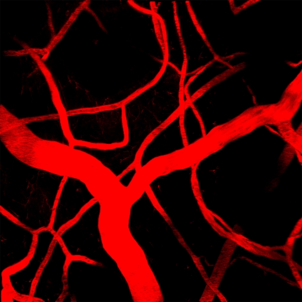 Two-photon image of blood vessels with Evans Blue after tail vein injection