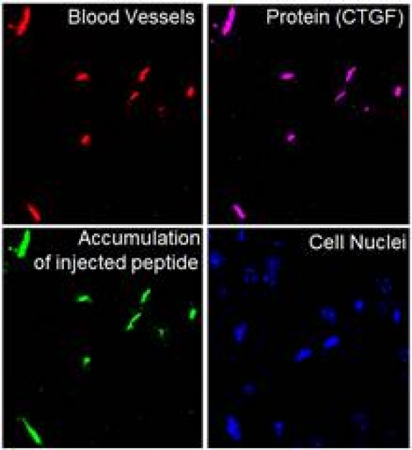 A peptide homing to early lesions of Alzheimer&#039;s disease reported in Nature Communications