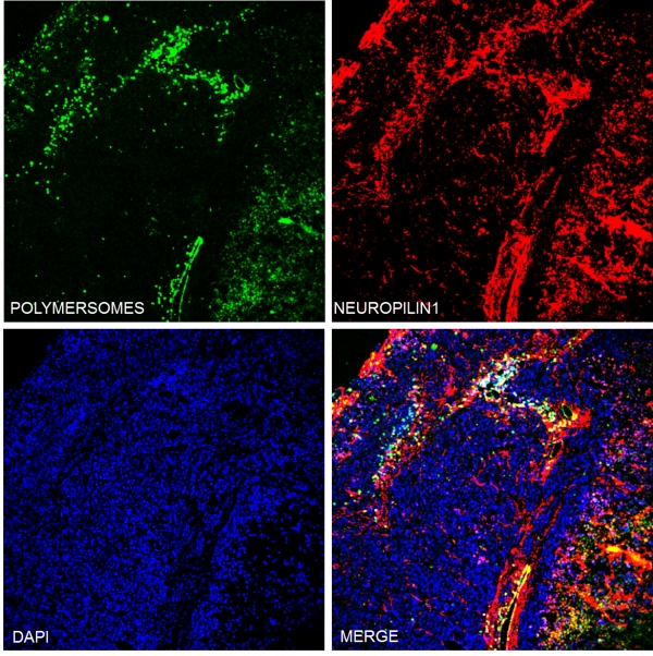 Targeted polymersomes penetrate deep into peritoneal tumors