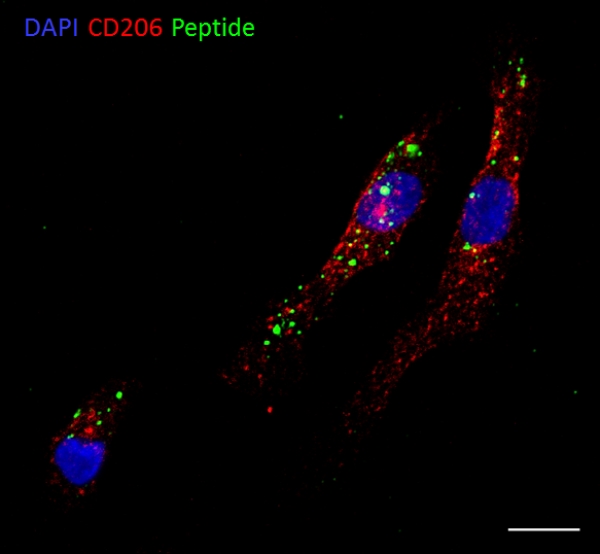 Peptide targeted polymersomes bind to M2 human macrophages