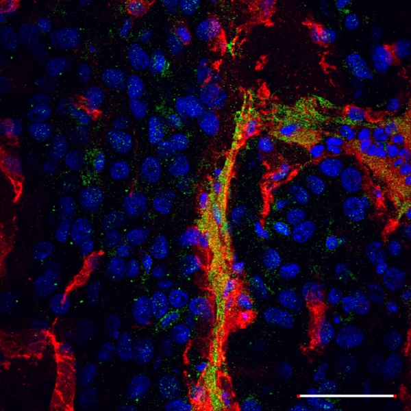 Linear TT1 peptide-coupled FAM-labeled iron oxide nanoparticles home to blood vessels of subcutaneous U87 tumor xenograft