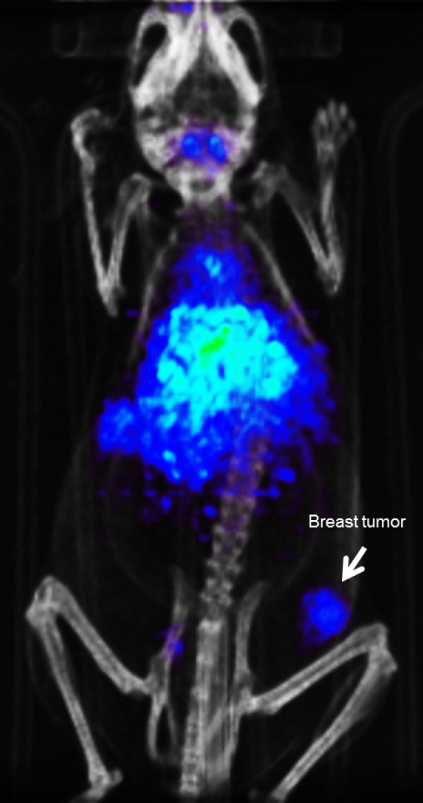 PET-CT image of breast tumor bearing mouse i.v. injected with iRGD targeted nanoparticles