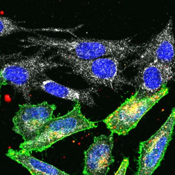 Co-culture of NRP1 (green) expressing PPC1 cells along with M21 cells; both cell lines express p32 (white), RPARPAR-AgNPs (red) are taken up by PPC1 cells.