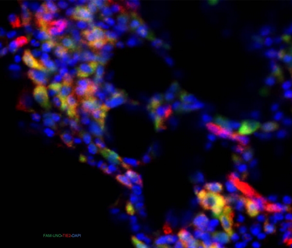 FAM-UNO homes to TIE2+ tumor macrophages