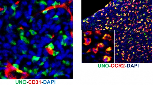 Intravenously injected &quot;UNO&quot; peptide enters​ protumoral macrophages