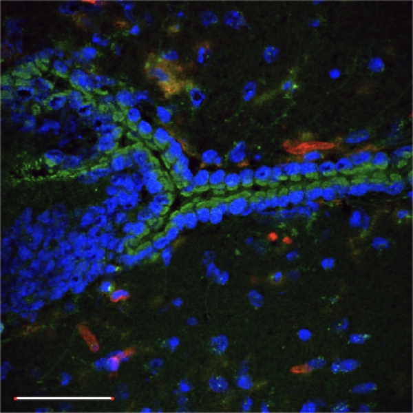 Glih27 peptide conjugated with iron oxide nanoworms (green) in mouse brain with VEGF KO glioblastoma