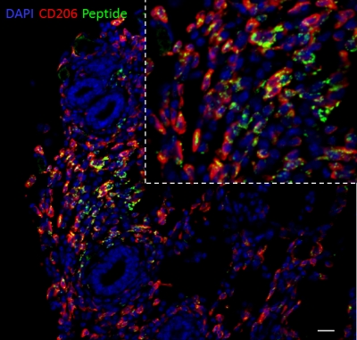 Polymersomes targeted with an M2 macrophage binding peptide in a mouse model of triple negative breast cancer