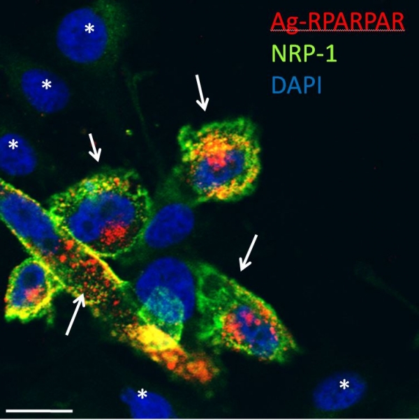 Selective internalization of RPARPAR silver nanoparticles (Ag-RPARPAR) in NRP-1 expressing cells.  In mixed culture, Ag-RPARPAR are taken by NRP-1 (green)-expressing PPC1 prostate carcinoma cells but not by M21 melanoma cells not expressing NRP-1.