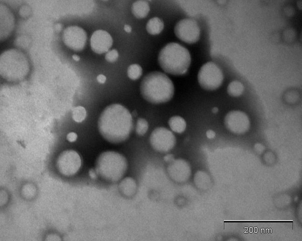 TEM image of PEG-PDPA Polymersomes at 105,000x magnification
