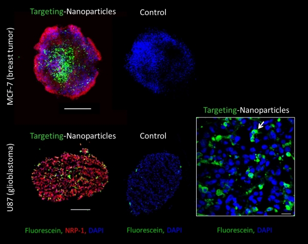 Targeting-polymeric nanoparticles are internalized in MCF-7 and U87 spheroids