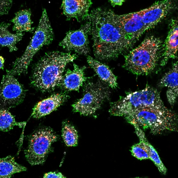PC3, prostate cancer cells, taking up RPARPAR-AgNPs (red), also showing NRP1 expression (green) and p32 expression (white)