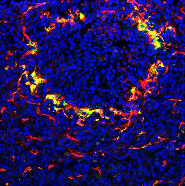 Circular structure of blood vessels homing FAM-labeled nanoparticles in P3-stem like glioblastoma