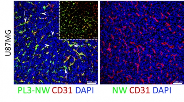 Systemic PL3-NWs accumulate in solid tumors. The U87-MG glioblastoma mice were systemically injected with PL3-NWs or control-NWs. Five h later, the animals were intracardially perfused with DMEM/BSA and the tumors and control organs were snap-frozen, sectioned, immunoassay with rabbit anti-FAM (green), rat anti-CD31 (red) antibodies, counterstained with DAPI (blue) and imaged by confocal microscopy. Arrows point to PL3-NWs in the CD31-positive vessels, and arrowheads point to extravasated PL3-NWs in the tumor parenchyma. Author: Prakash Lingasamy